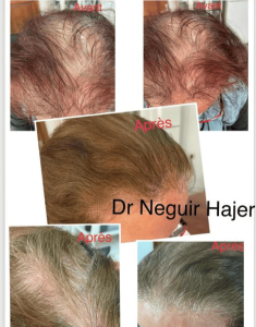Dermatologue à Ksar Hellal / maladies de cheveux et de la peau