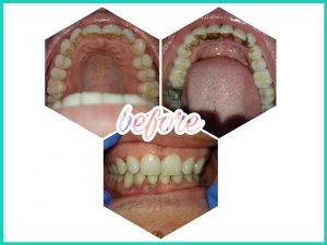 Soins et détartrage des dents / Cabinet dentaire Sousse